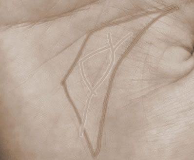 ſڣ©ƺĲ